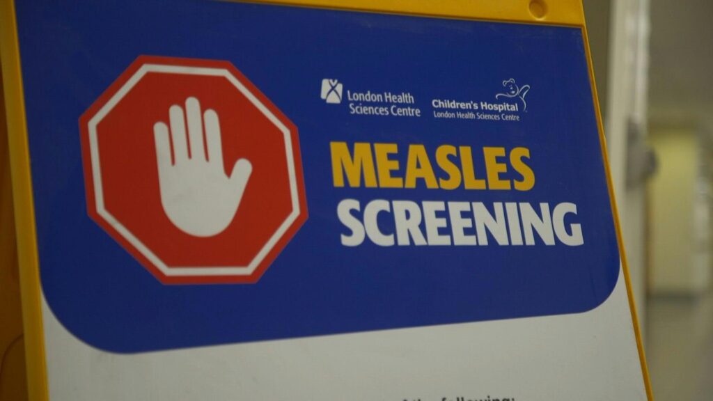 Canada reports first death linked to measles epidemic