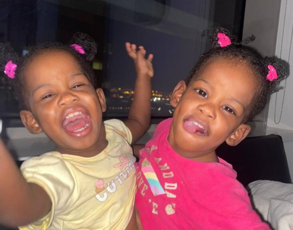 Conjoined twins successfully separated in Saudi Arabia