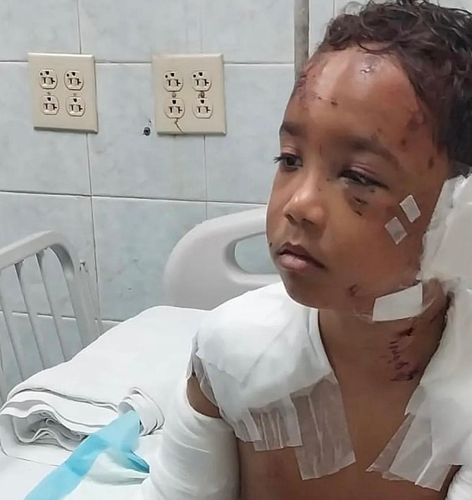 ‘Long journey to healing’ for boy who spent eighth birthday in ICU after dog mauling