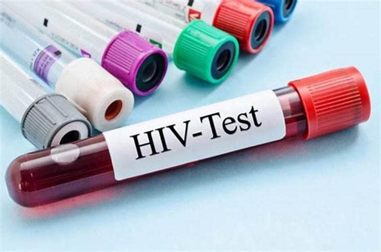 Antigua and Barbuda to Host First Public HIV Awareness Symposium As Cases Rise