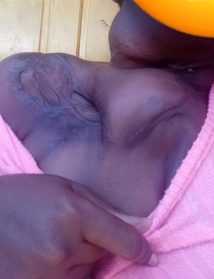 Small neck bump changes everything for mom of two