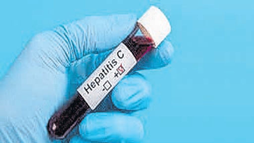 World going too slow on eliminating hepatitis — WHO
