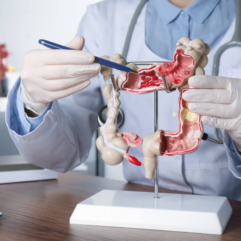 More young adults are being diagnosed with gastrointestinal cancers