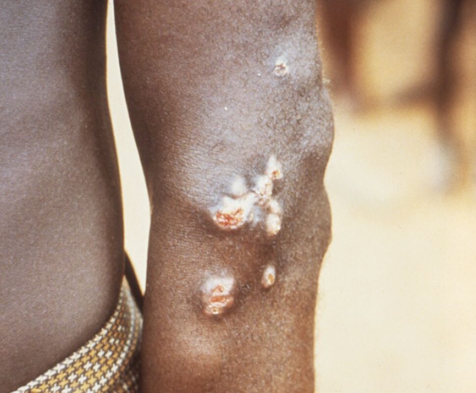 Our health heritage